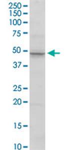 MMP3 Antibody in Western Blot (WB)