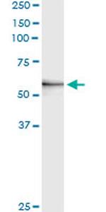 MMP3 Antibody in Immunoprecipitation (IP)