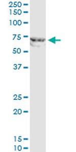 MMP12 Antibody in Western Blot (WB)