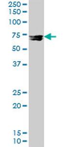 MMP12 Antibody in Western Blot (WB)