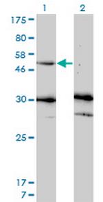 MMP13 Antibody in Western Blot (WB)