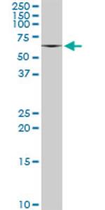 MPP3 Antibody in Western Blot (WB)