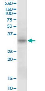 MPST Antibody in Western Blot (WB)