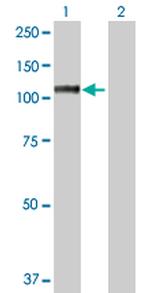 MSH2 Antibody in Western Blot (WB)