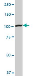 MSH2 Antibody in Western Blot (WB)