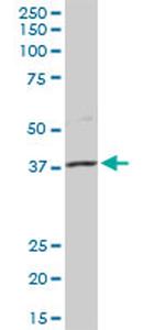 MSI1 Antibody in Western Blot (WB)