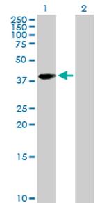 MSI1 Antibody in Western Blot (WB)