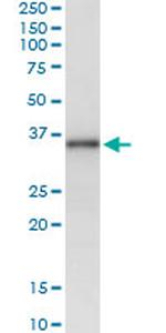 MSX1 Antibody in Immunoprecipitation (IP)