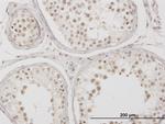 MSX2 Antibody in Immunohistochemistry (Paraffin) (IHC (P))