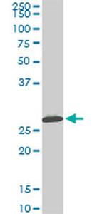 MTAP Antibody in Western Blot (WB)