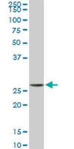 MTAP Antibody in Western Blot (WB)