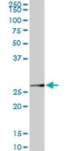 MTAP Antibody in Western Blot (WB)