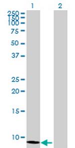 MTCP1 Antibody in Western Blot (WB)