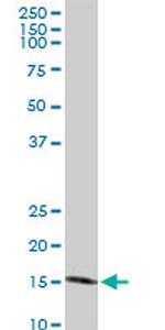 NUDT1 Antibody in Western Blot (WB)