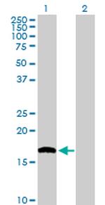 NUDT1 Antibody in Western Blot (WB)