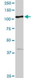 MTHFD1 Antibody in Western Blot (WB)