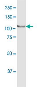 MTHFD1 Antibody in Western Blot (WB)