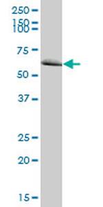 MTM1 Antibody in Western Blot (WB)