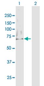 MTM1 Antibody in Western Blot (WB)