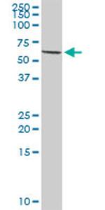 MTM1 Antibody in Western Blot (WB)