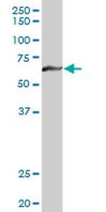 MTM1 Antibody in Western Blot (WB)