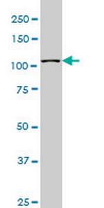 MUSK Antibody in Western Blot (WB)