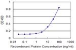 MUSK Antibody in ELISA (ELISA)