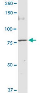 MUT Antibody in Western Blot (WB)