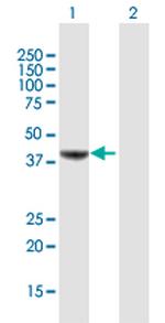 MVD Antibody in Western Blot (WB)