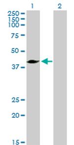 MVD Antibody in Western Blot (WB)