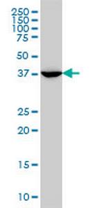 MVD Antibody in Western Blot (WB)