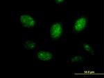 MYB Antibody in Immunocytochemistry (ICC/IF)