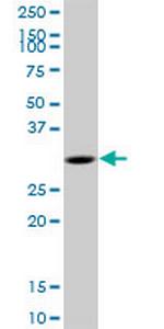 MYD88 Antibody in Western Blot (WB)