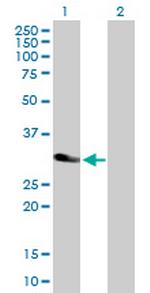 MYD88 Antibody in Western Blot (WB)