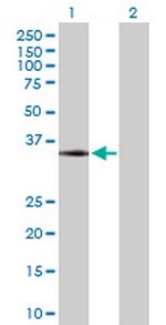 MYD88 Antibody in Western Blot (WB)