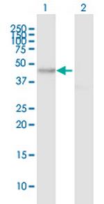 MYO1D Antibody in Western Blot (WB)