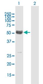 MYOC Antibody in Western Blot (WB)