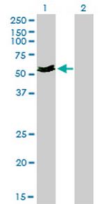 MYOC Antibody in Western Blot (WB)