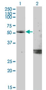 MYOC Antibody in Western Blot (WB)