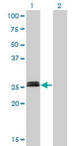 MYOG Antibody in Western Blot (WB)