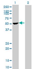 PPP1R12B Antibody in Western Blot (WB)