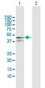 PPP1R12B Antibody in Western Blot (WB)