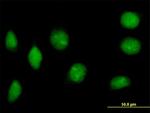 NAP1L2 Antibody in Immunocytochemistry (ICC/IF)