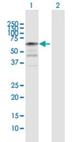 NAP1L2 Antibody in Western Blot (WB)