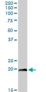 NBL1 Antibody in Western Blot (WB)