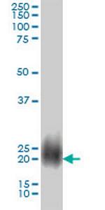 NBL1 Antibody in Western Blot (WB)