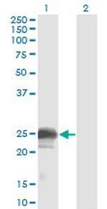 NBL1 Antibody in Western Blot (WB)