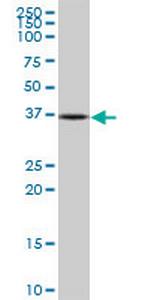 NUBP1 Antibody in Western Blot (WB)