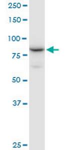 NCBP1 Antibody in Western Blot (WB)