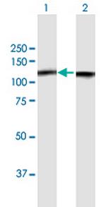 NCL Antibody in Western Blot (WB)